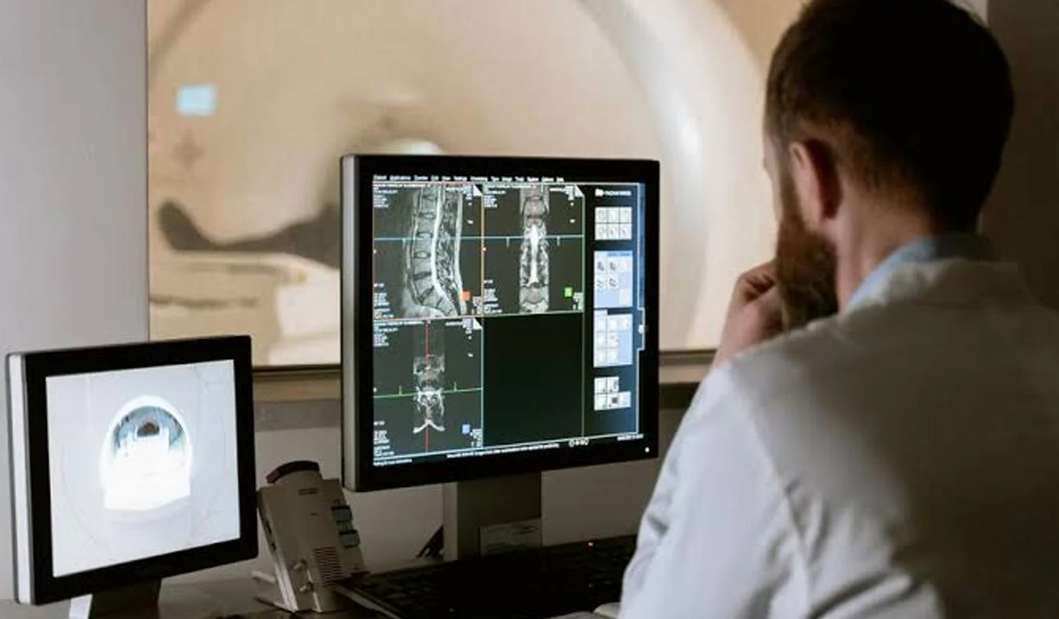 CT Dose Optimisation